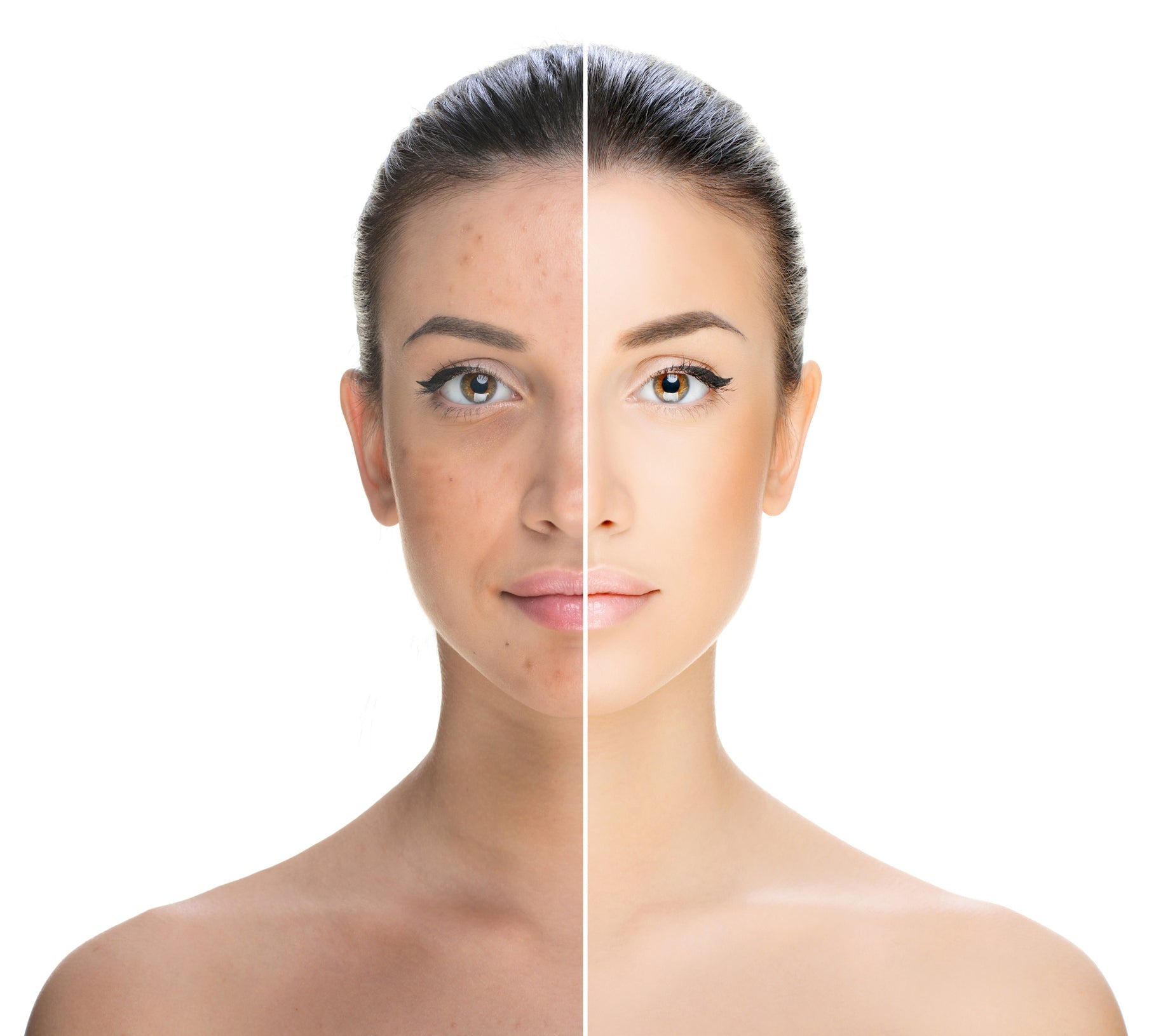 Does Retinol Increase Collagen? How It Works, Benefits, And More | XND