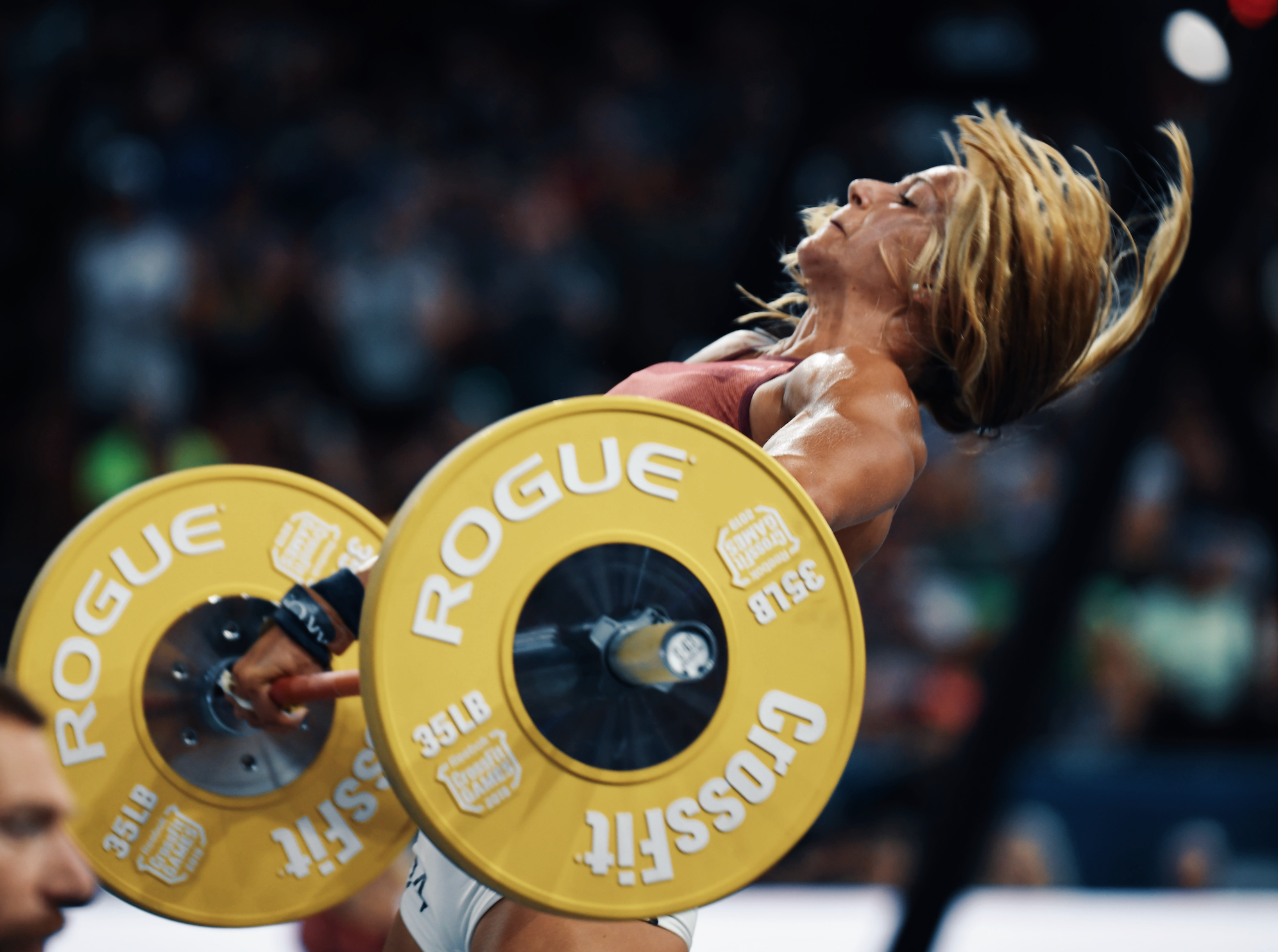 Rhabdomyolysis: The Hidden Danger of Pushing Yourself Too Hard